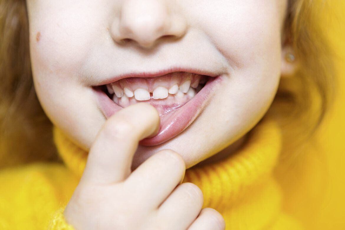 Enjoy your child's baby teeth moment - Boston Children's Answers