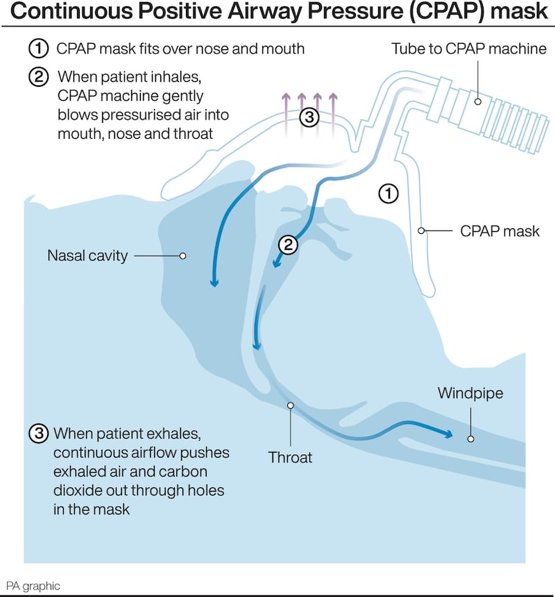 Coronavirus: Mercedes Formula One team helps develop breathing machine for patients