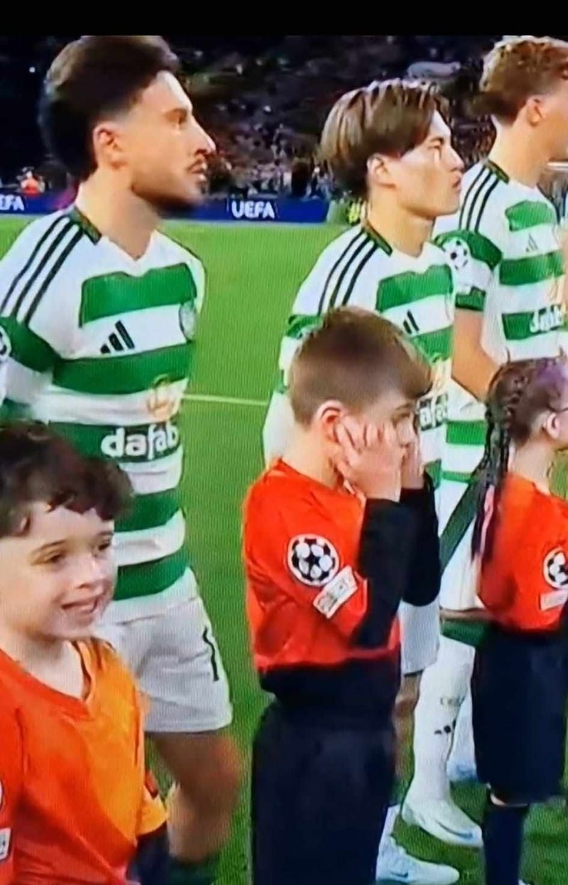 The pre match noise from supporter at Celtic Park left Kaleb covering his ears