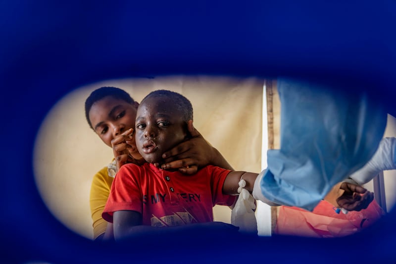 A health worker attends to an mpox patient at a treatment centre in Munigi (Moses Sawasawa/AP)