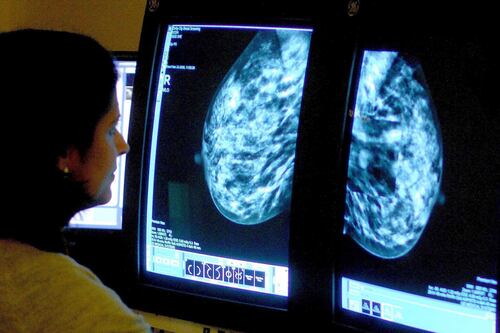 Red flag cancer referrals can never be delayed by new computer system again - Deirdre Heenan