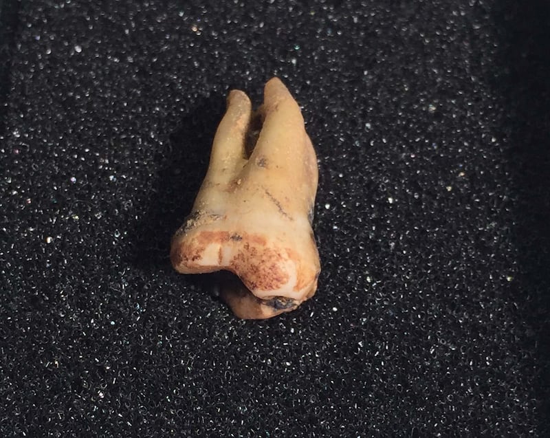 The tooth