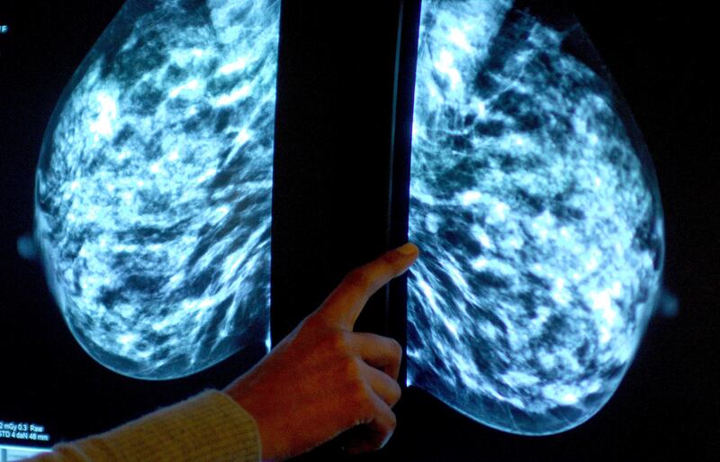 A mammogram showing female breasts in order check for breast cancer