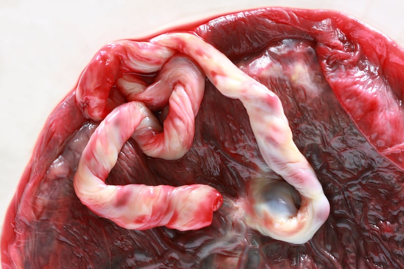 Placenta.