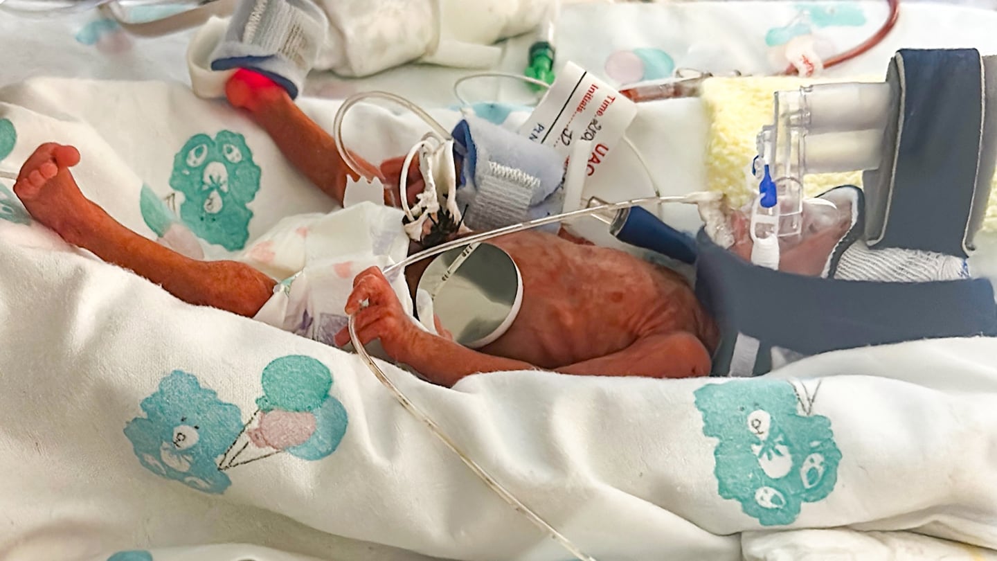 Most Premature Baby Ever Born in Ireland Heads Home to Spend Christmas With Family