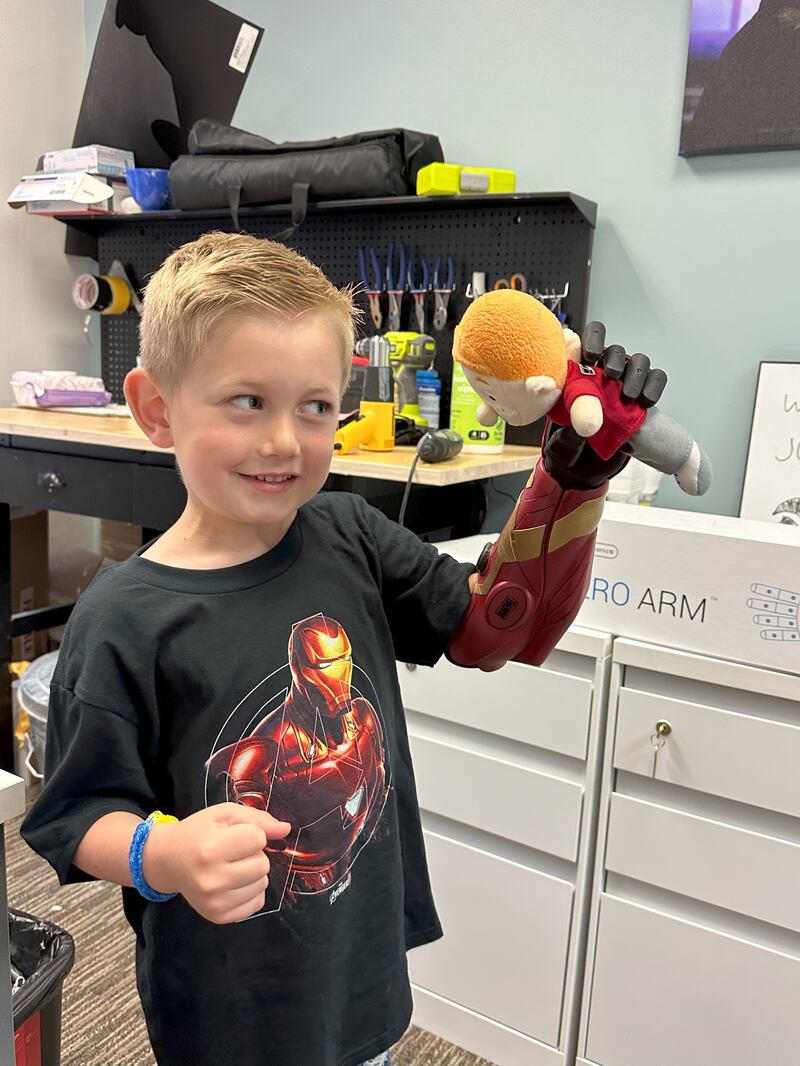 Jordan Marotta, five, has become the youngest person in the world to get a bionic Hero Arm.