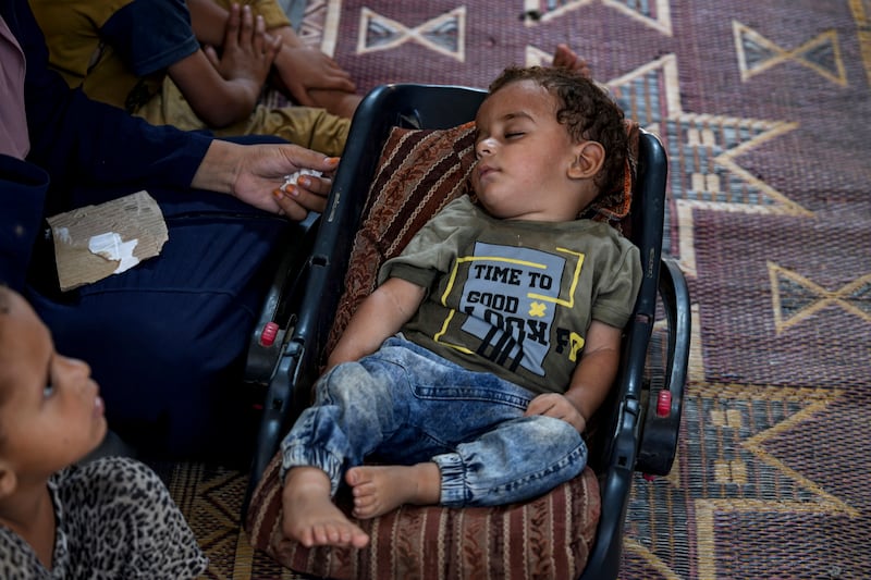 Displaced infant Abdel-Rahman Abu El-Jedian, who suffers from polio, sleeps at a makeshift tent camp in Deir al-Balah, central Gaza Strip (Abdel Kareem Hana/AP)