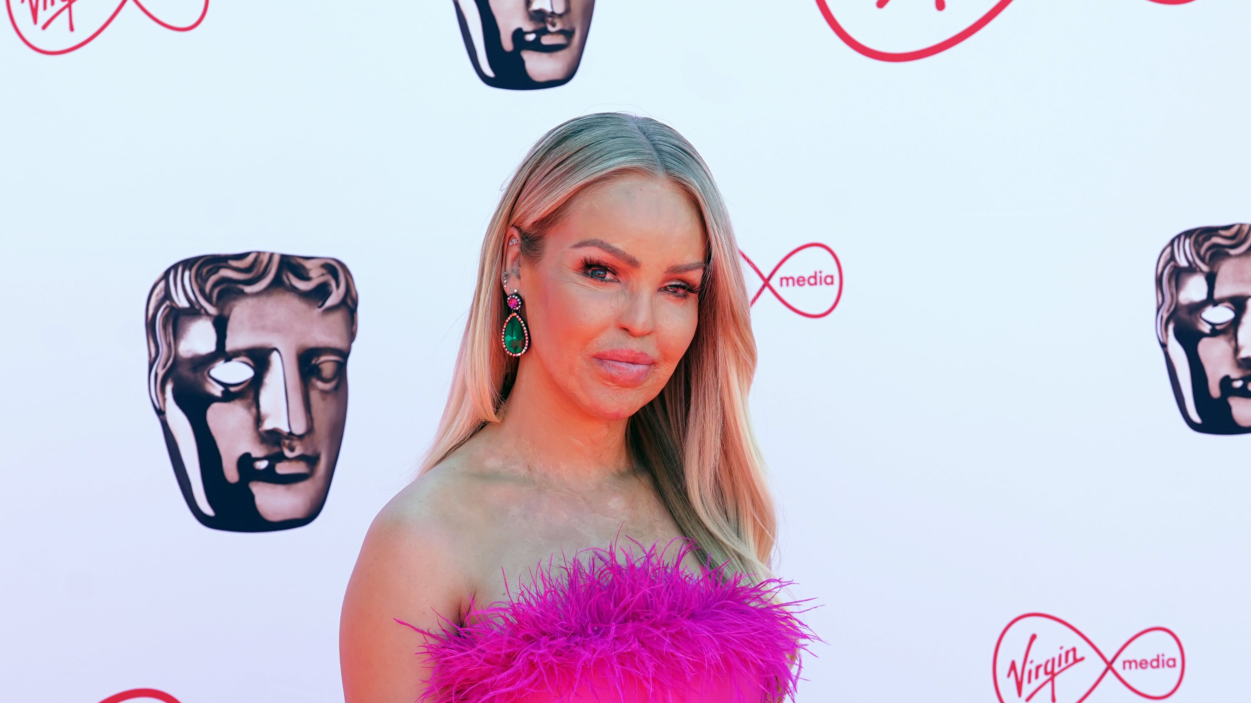 Katie Piper was left blind in one eye during the attack in March 2008