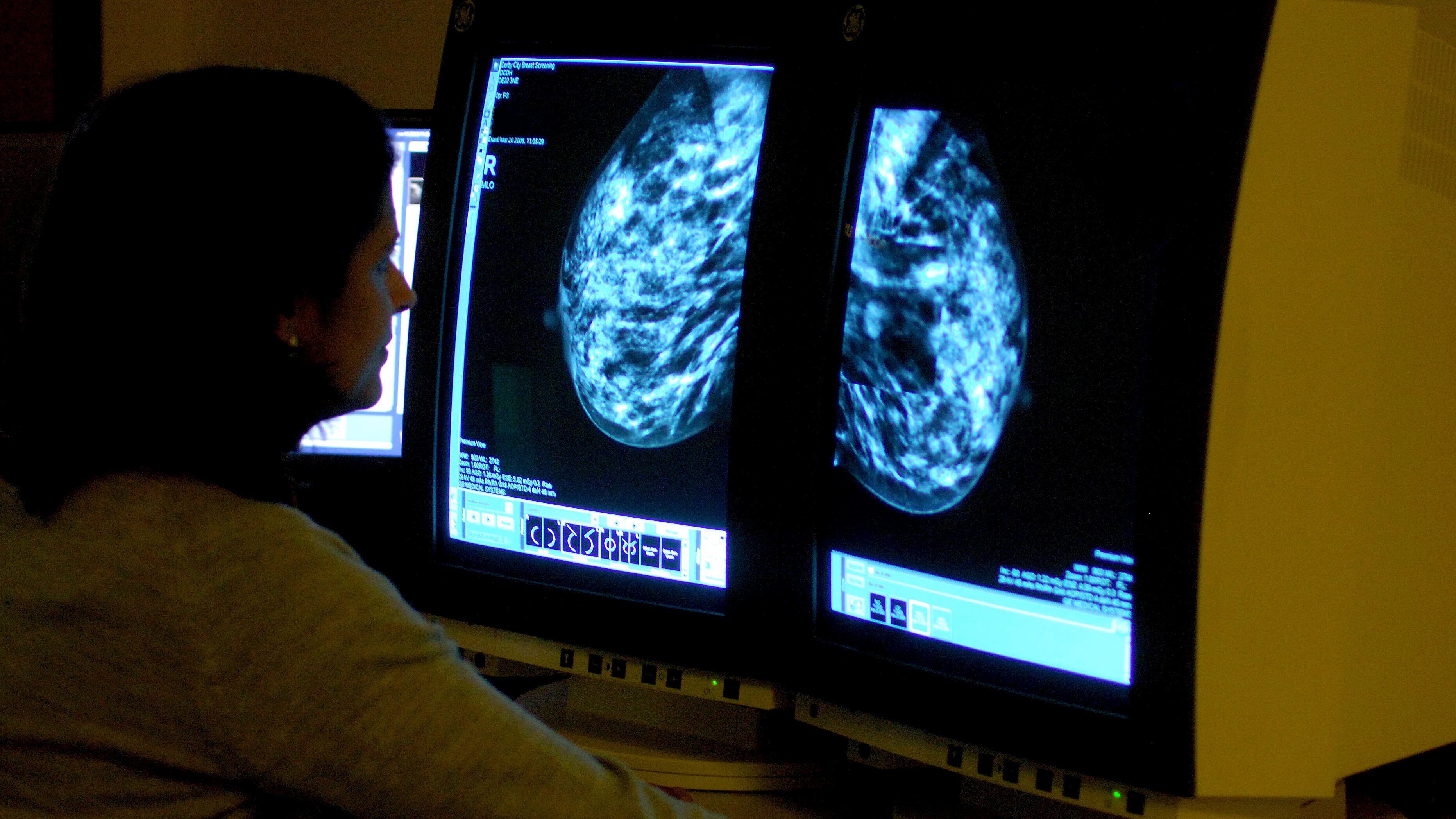 Cancer care is lagging far behind other European countries, data reveals