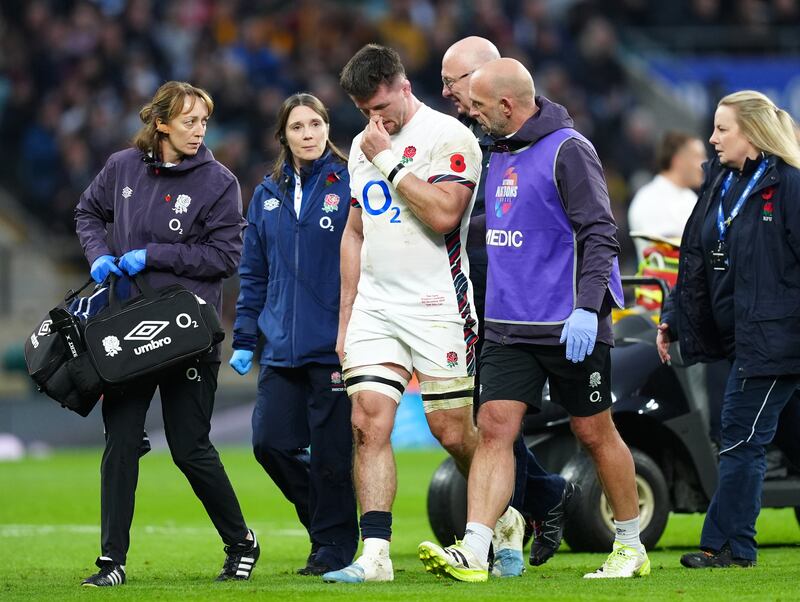 Tom Curry is led off the field after suffering a concussion