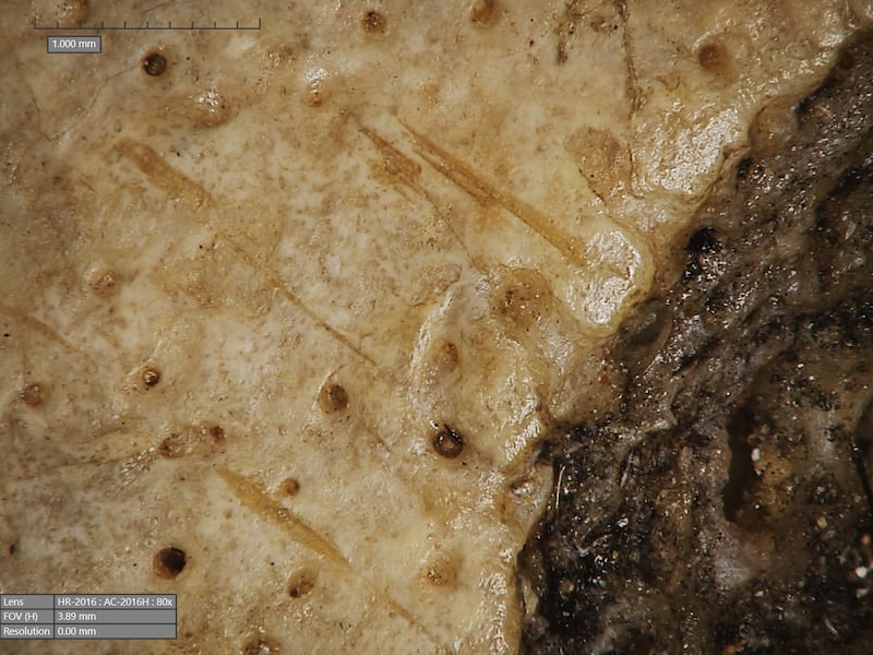 Smaller lesions on the skull showing cutmarks (Tondini/Isidro/Camaros/Frontiers in Medicine)