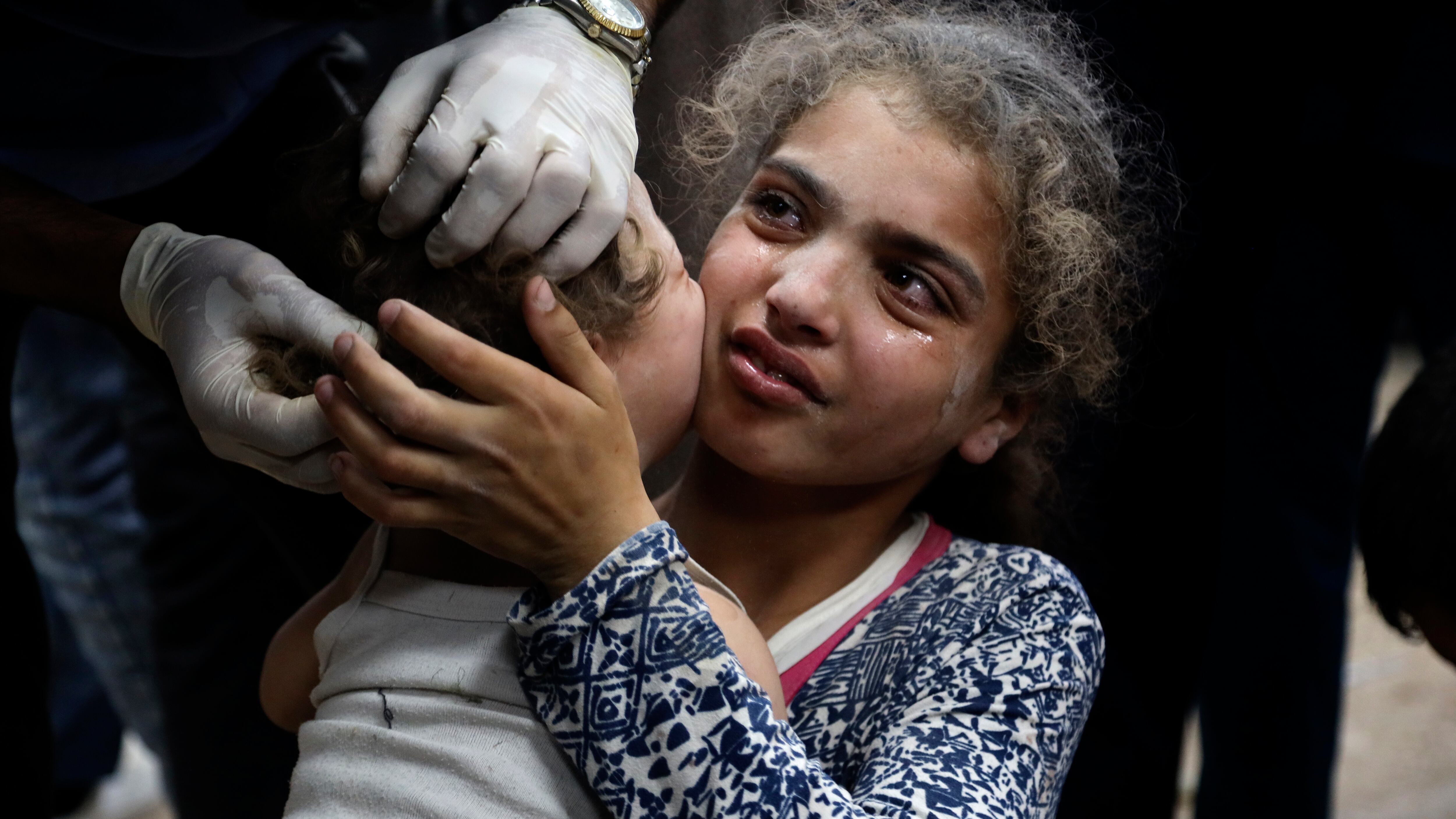 Palestinian children wounded in the Israeli bombardment on a residential building in Bureij refugee camp, are treated at al-Aqsa Martyrs hospital in Deir al-Balah, central Gaza Strip (AP)