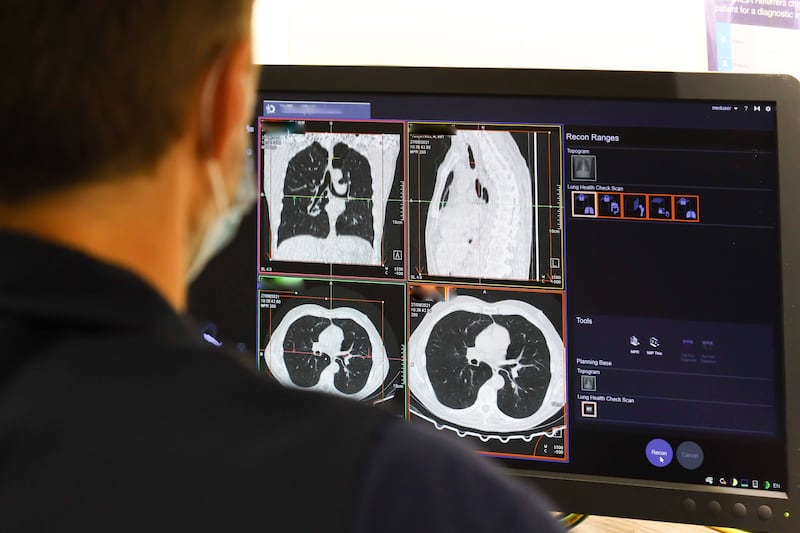 An NHS worker looks at the results of a lung scan, part of the NHS Targeted Lung Health Check Programme