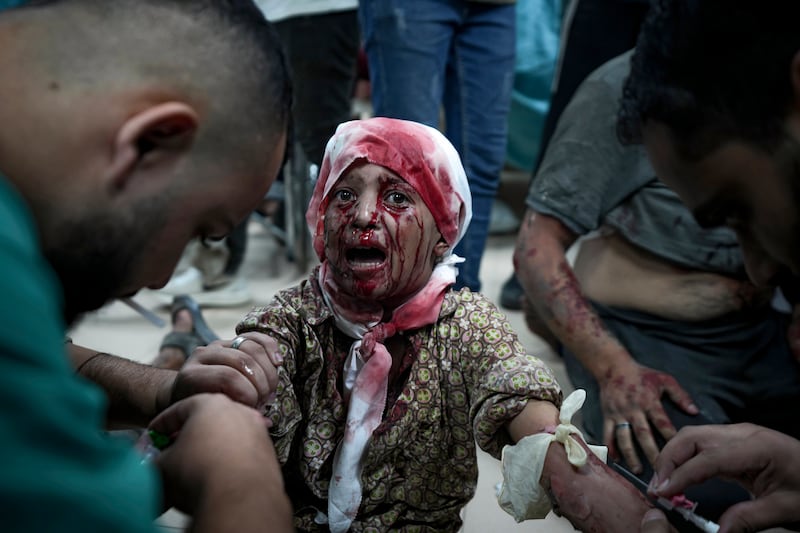 A Palestinian child wounded in the Israeli bombardment of the Gaza Strip is treated at a hospital in Deir al-Balah (Abdel Kareem Hana/AP)