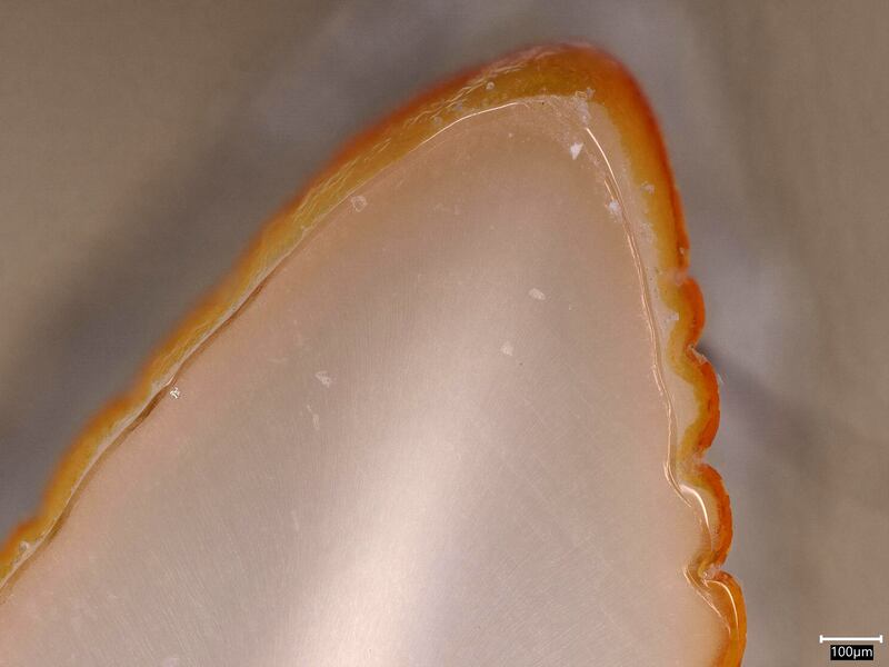 A Komodo dragon’s tooth stained orange by iron (Dr Aaron LeBlanc/King’s College London)