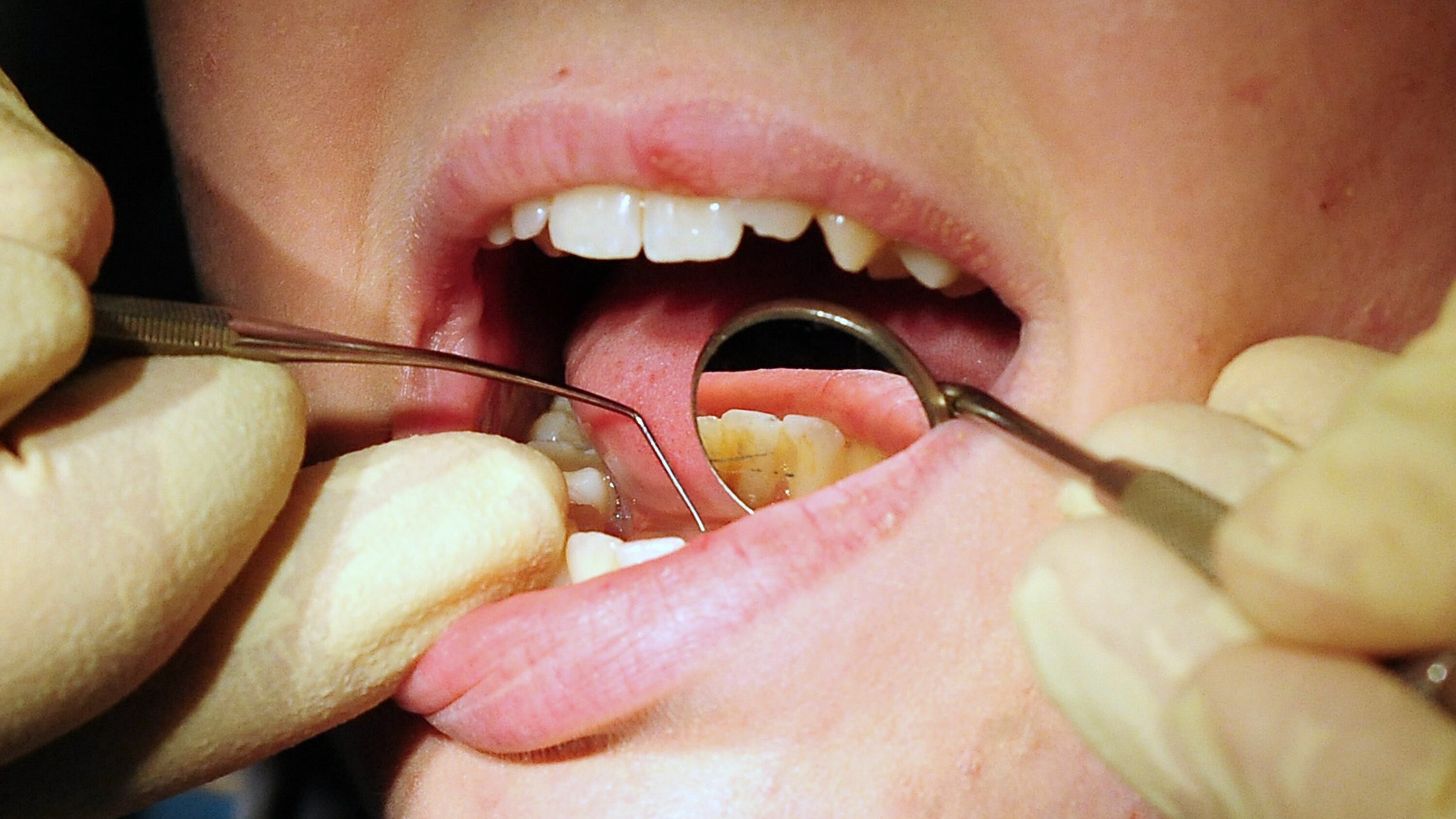 Labour wants to clear a dental treatment backlog