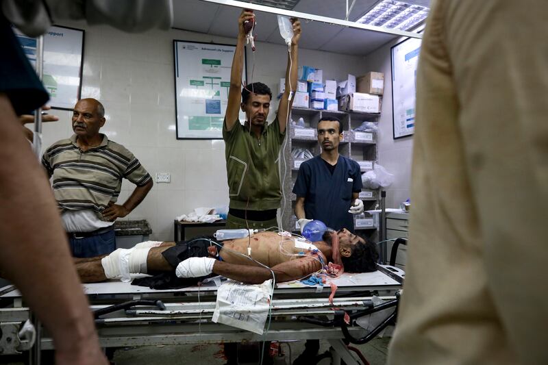 A Palestinian man injured in the Israeli bombardment of the Gaza Strip is treated in a hospital in Khan Younis (Jehad Alshrafi/AP)