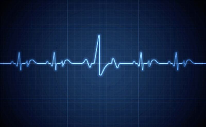 An ECG is the gold standard in heart monitoring 