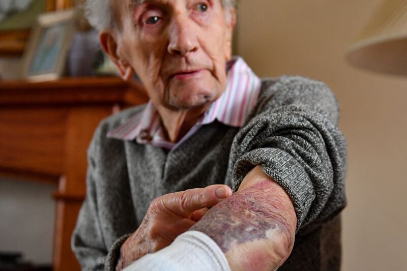 102-year-old fights off burglar