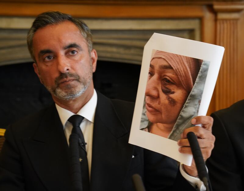 Solicitor Aamer Anwar holds up a picture of the injury allegedly suffered by Shameem Akhtar