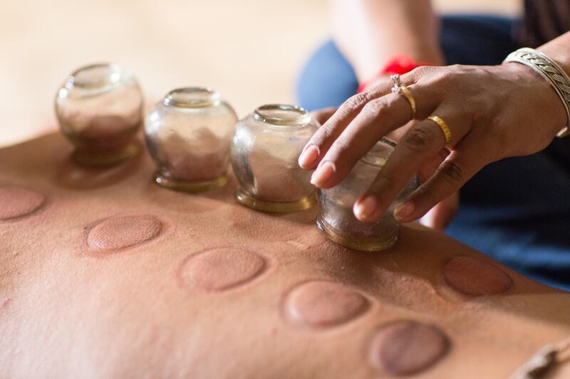 Cupping therapy involves glass or cups