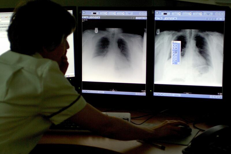 AI could help radiologists to interpret chest X-rays in the future