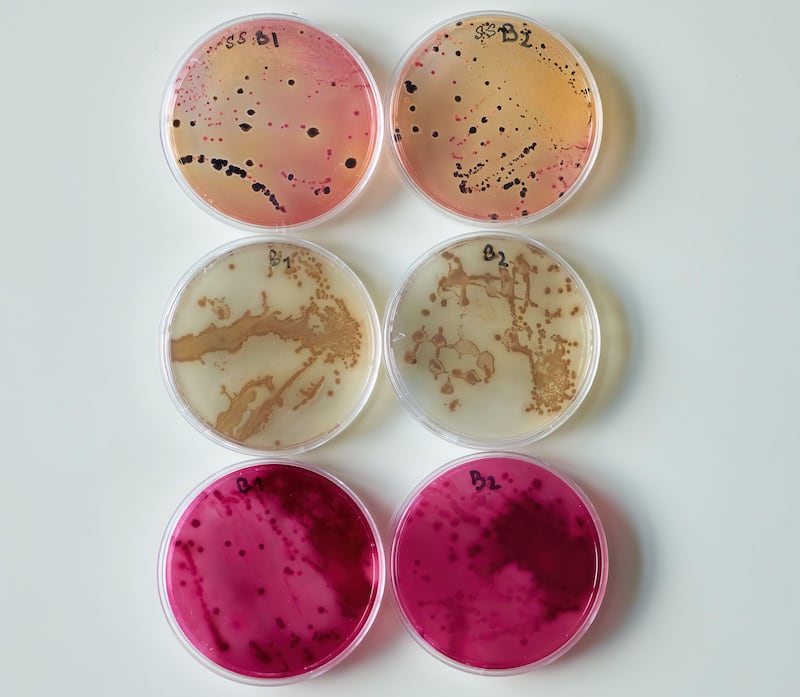 Bacterial colony in petri dishes