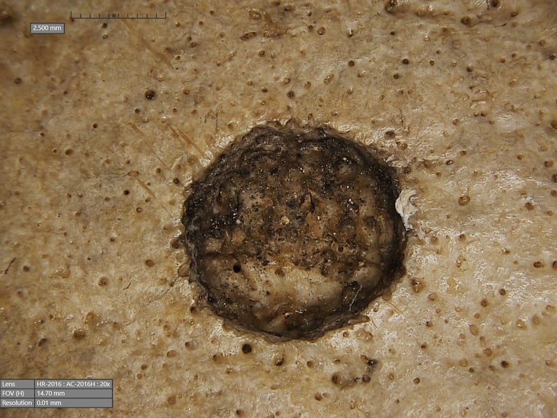 Cutmarks found on the skull of a male individual, thought to have been made with a sharp object (Tondini/Isidro/Camaros/Frontiers in Medicine)