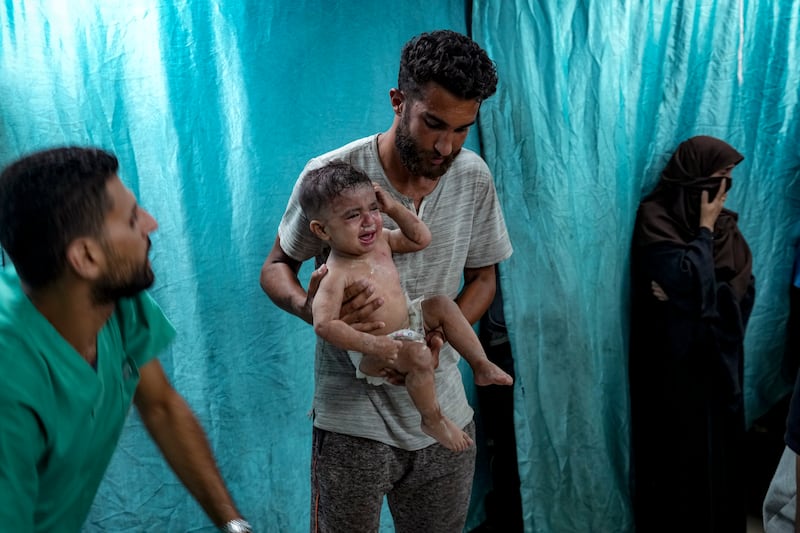 A Palestinian man holds a child wounded in the Israeli bombardment of the Gaza Strip in a hospital (Abdel Kareem Hana/AP)