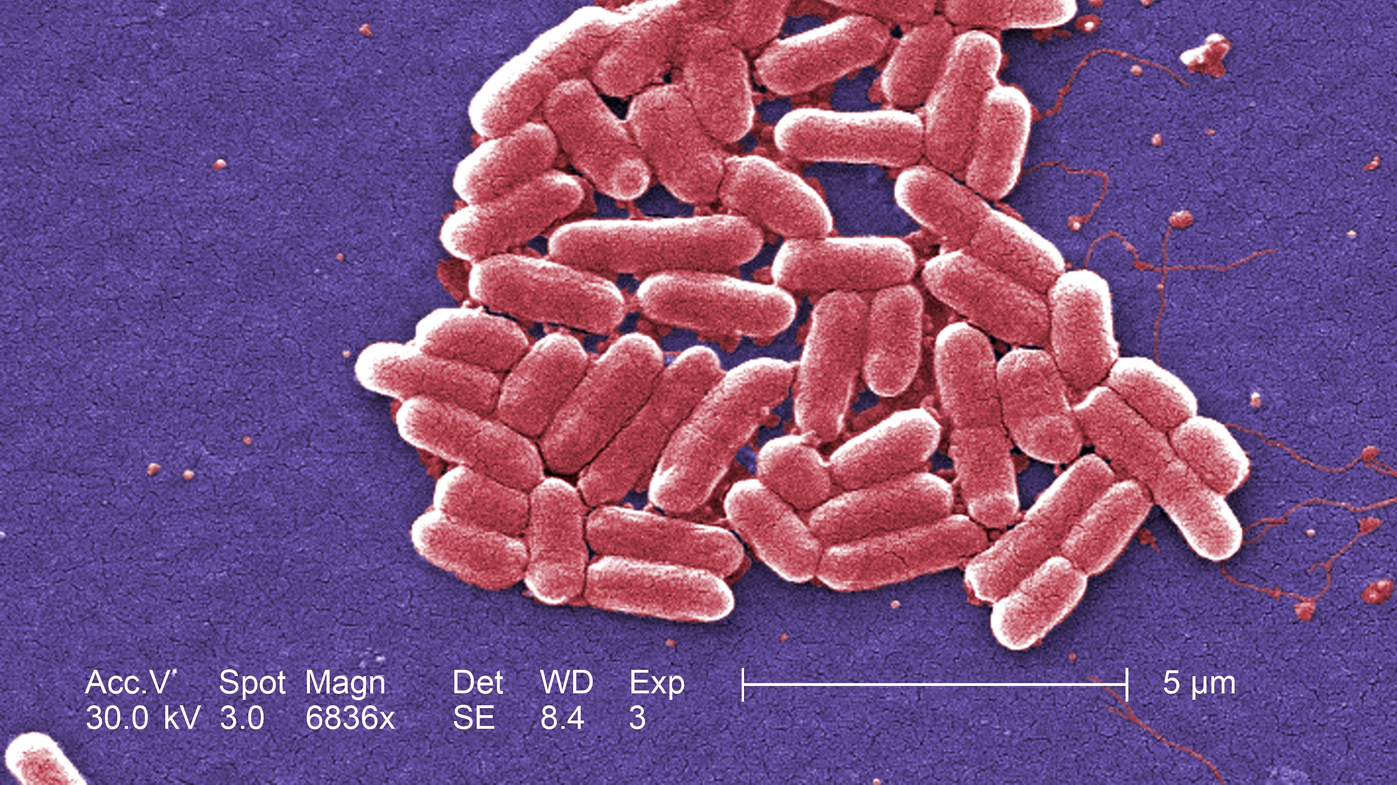 E.coli is a diverse group of bacteria that are normally harmless and live in the intestines of humans and animals