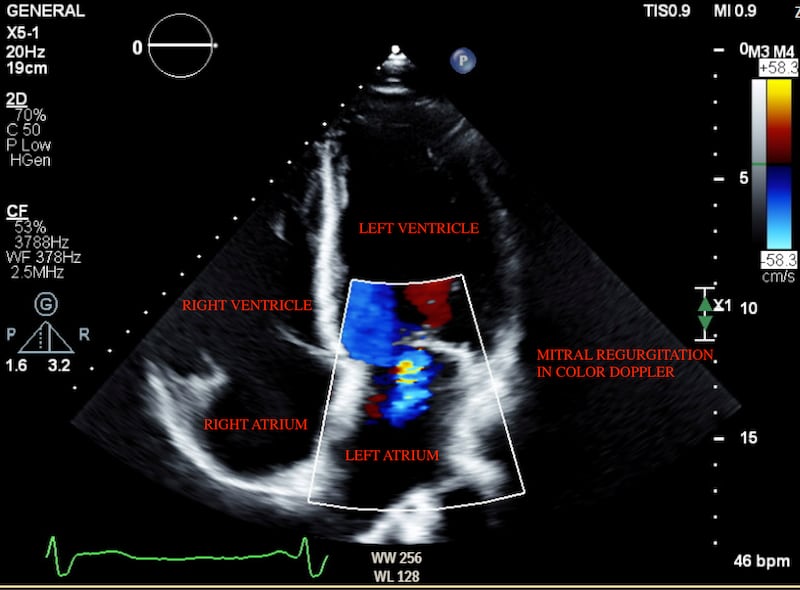 The pilot project saw the team develop software capable of quickly and accurately scanning heart echo images (ultrasound scans) and other medical data