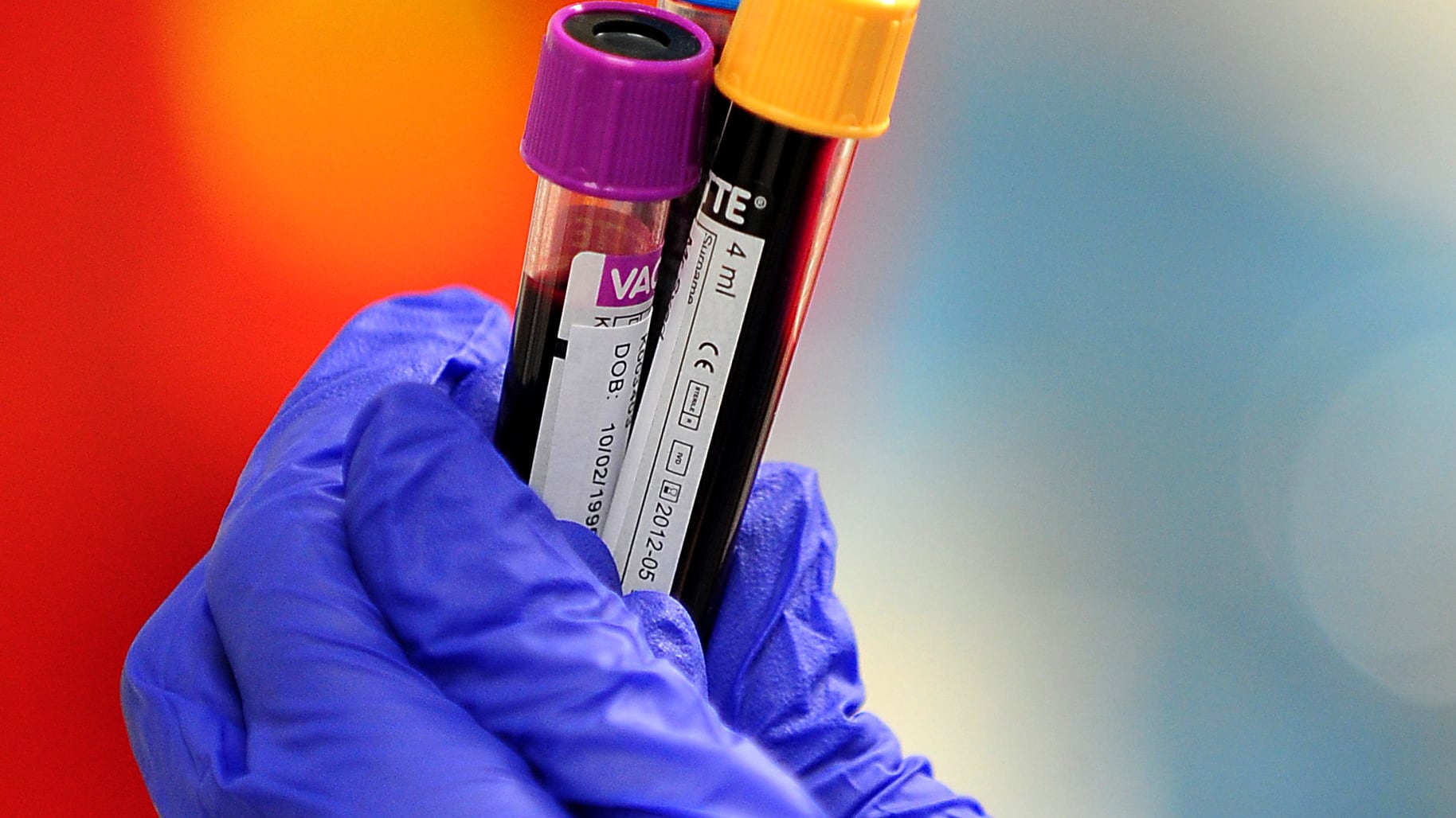 A generic stock photo of blood samples being held