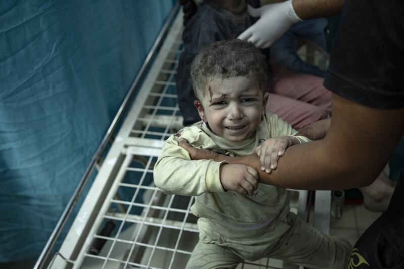 A Palestinian child wounded in Israeli bombardment of the Gaza Strip 