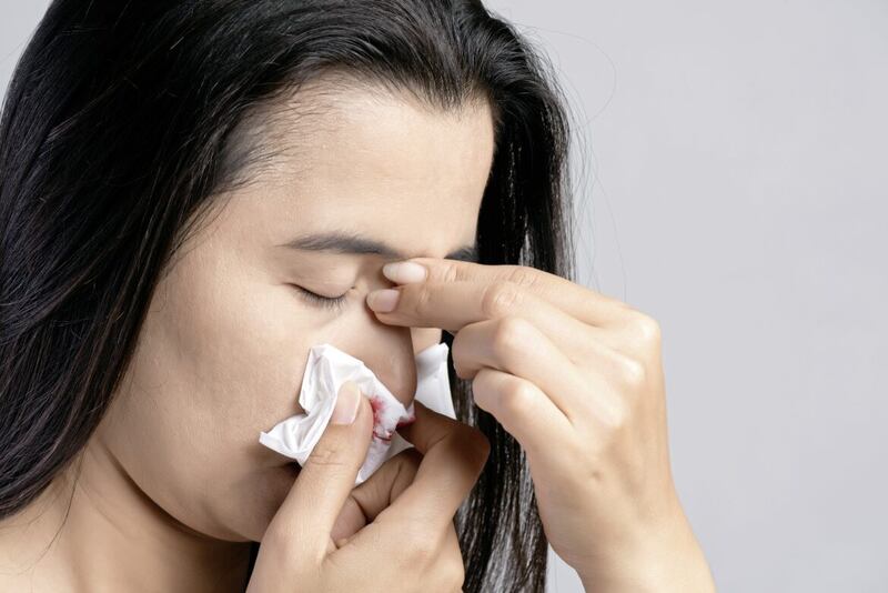 Dry air, for example caused by central heating, is a common cause of nosebleeds 