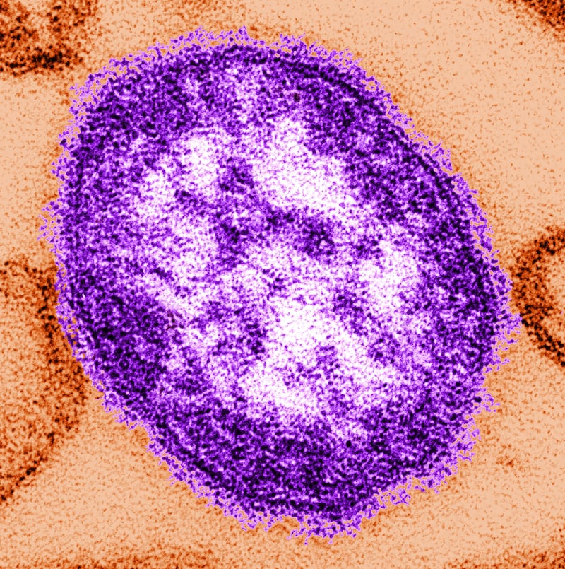 There have been more than 300 cases of measles in the West Midlands since October (handout)